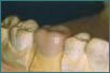 Coroas