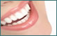 Vídeo Implantes Dentários